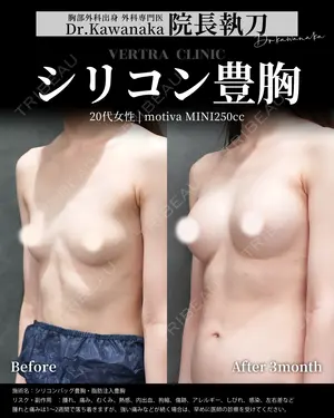90 days after image