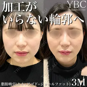 null days after image