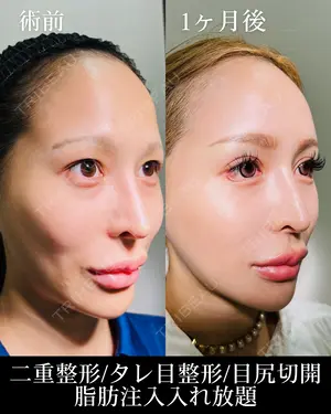 30 days after image