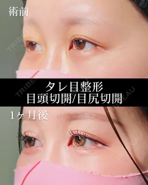 30 days after image