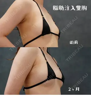 null days after image