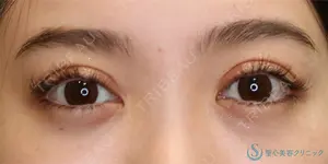 180 days after image
