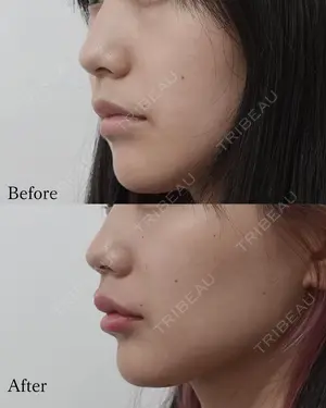 before image