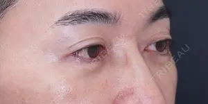 60 days after image