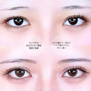 before image