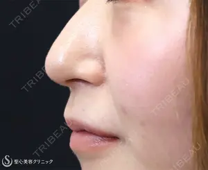 7 days after image