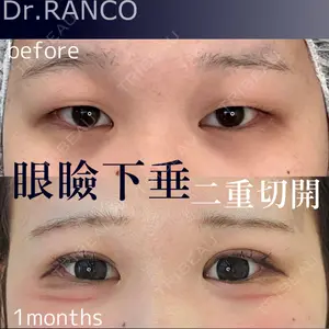30 days after image