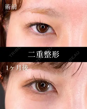 30 days after image