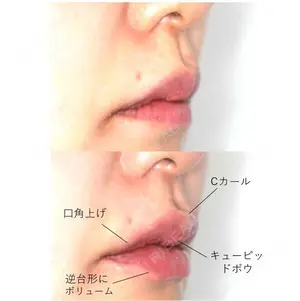 before image