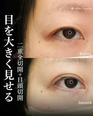 90 days after image