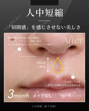 90 days after image