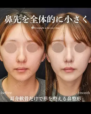 30 days after image