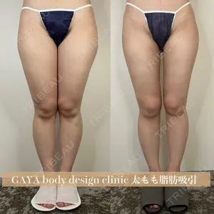 30 days after image