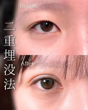 before image