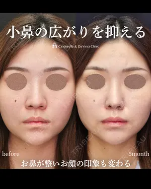 150 days after image