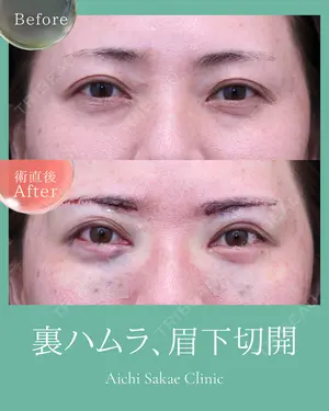 before image