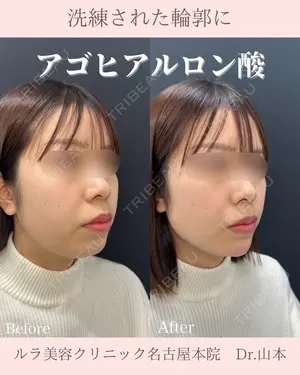 before image