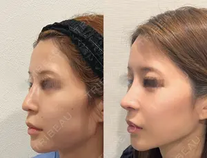 30 days after image