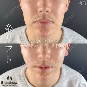 before image