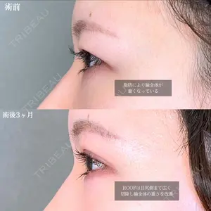 before image