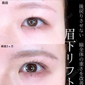 90 days after image