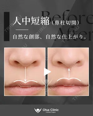180 days after image