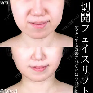180 days after image