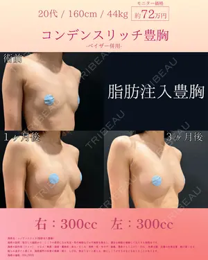 90 days after image