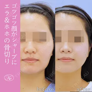 180 days after image