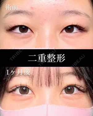 before image