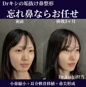 90 days after image