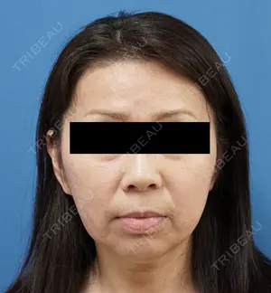 90 days after image