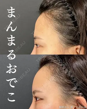 before image