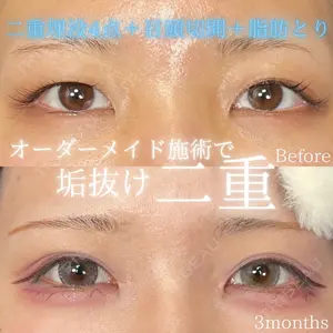 90 days after image