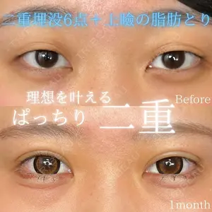 30 days after image