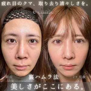60 days after image