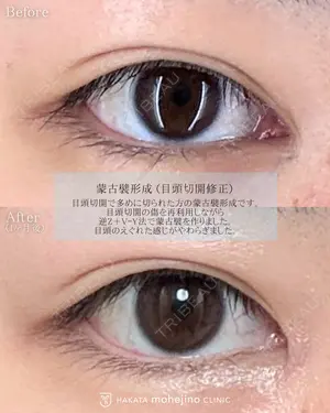 before image