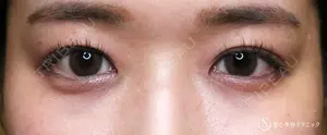 30 days after image