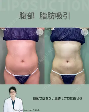 before image
