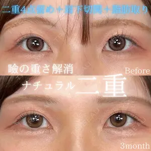 90 days after image