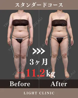 90 days after image