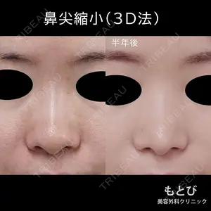 180 days after image