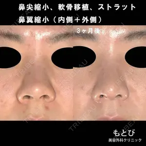 90 days after image