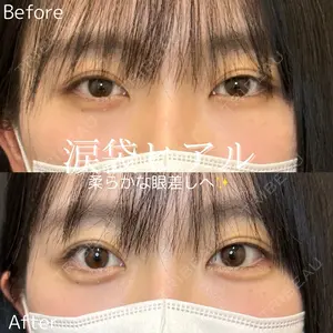 before image