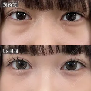 before image