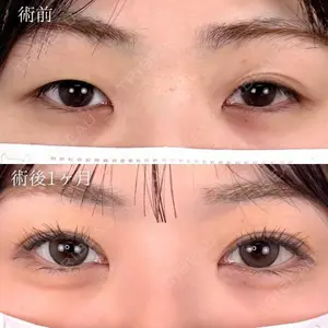 before image
