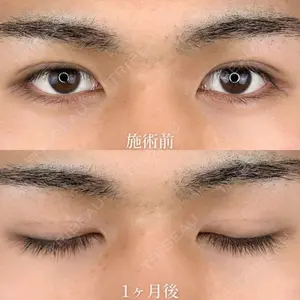 before image