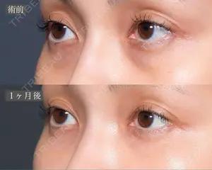 before image