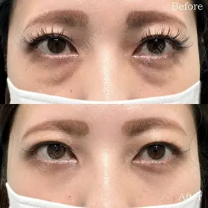 before image