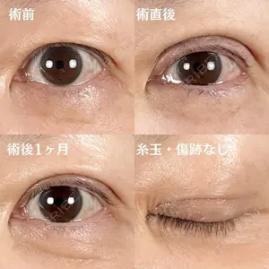 before image